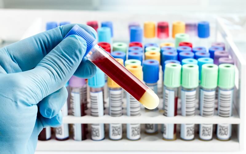 Equine Diagnostics