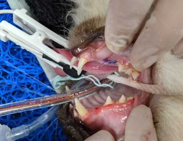 Zami Surgery